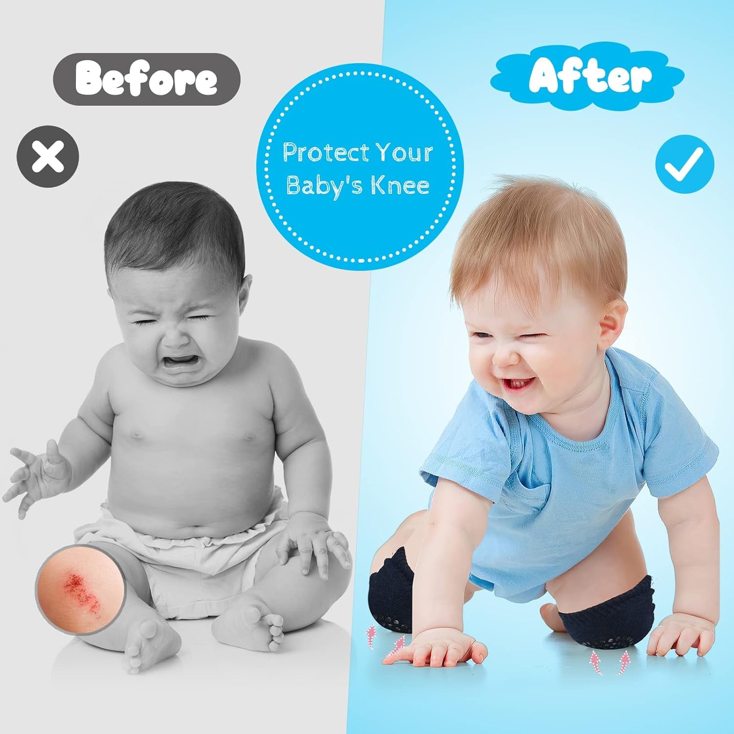 Baby Crawling Pads Anti-Slip Knee Protect Baby’S Knee for Crawling